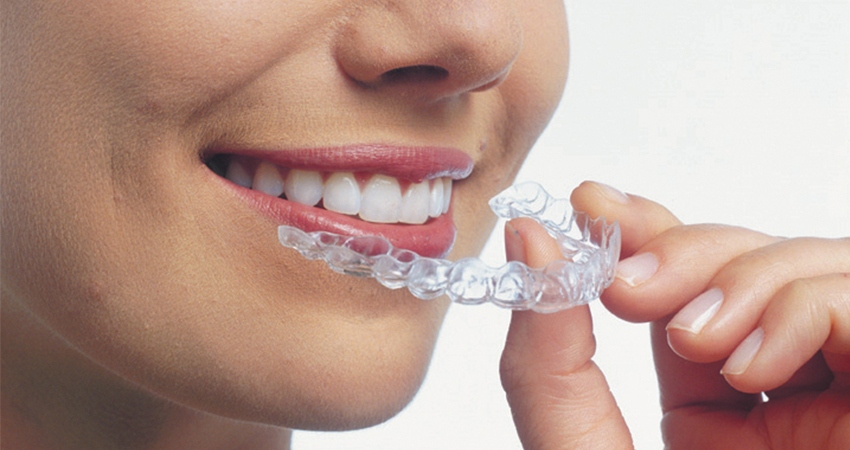 Woman Smiling Holding Clear Aligners